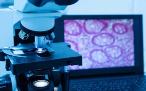 Modern microscope and human tissue section slide with computer m